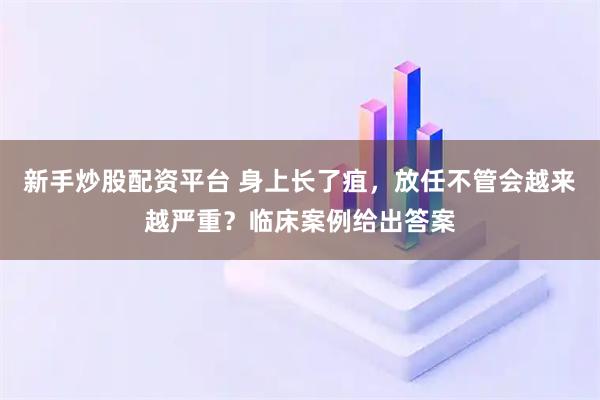 新手炒股配资平台 身上长了疽，放任不管会越来越严重？临床案例给出答案